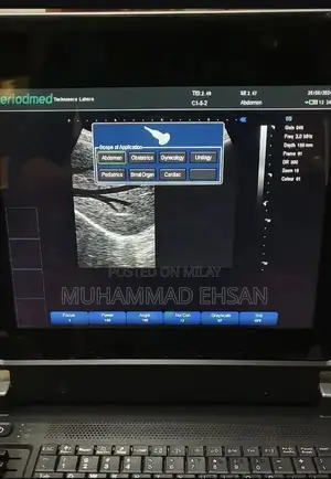 Portable Digital Grey Scale Ultrasound Diagnostic System