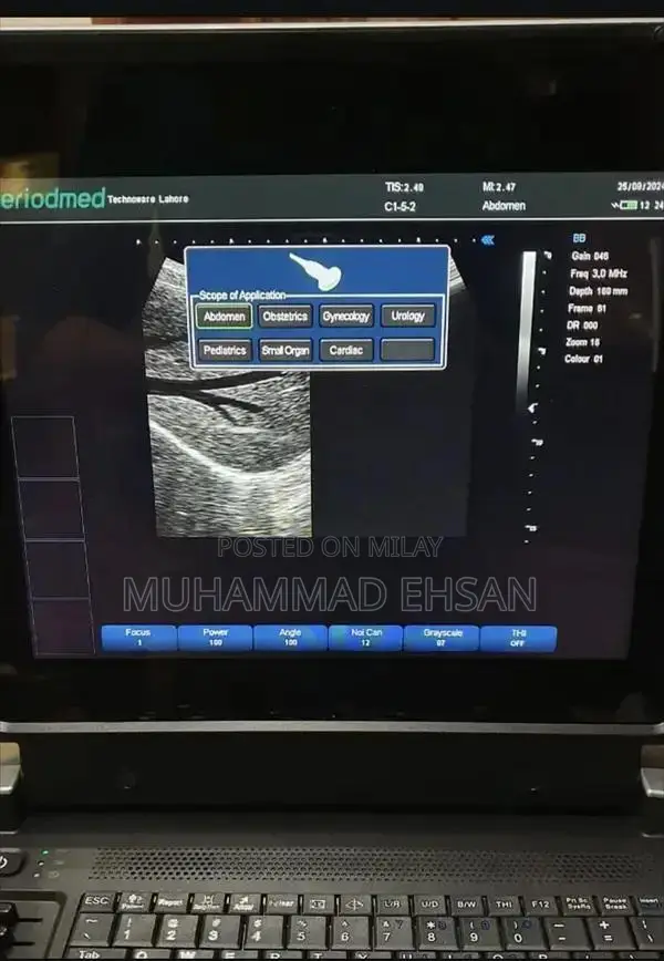 Portable Digital Grey Scale Ultrasound Diagnostic System