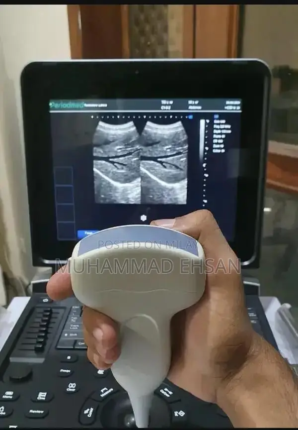 Portable Digital Grey Scale Ultrasound Diagnostic System