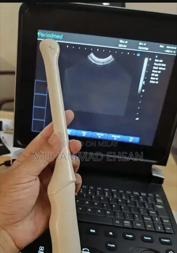 Portable Digital Grey Scale Ultrasound Diagnostic System