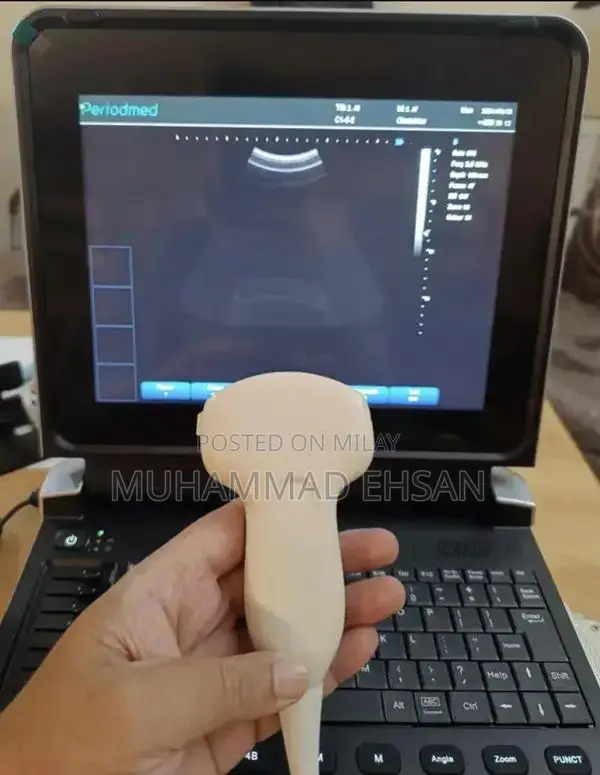 Portable Digital Grey Scale Ultrasound Diagnostic System