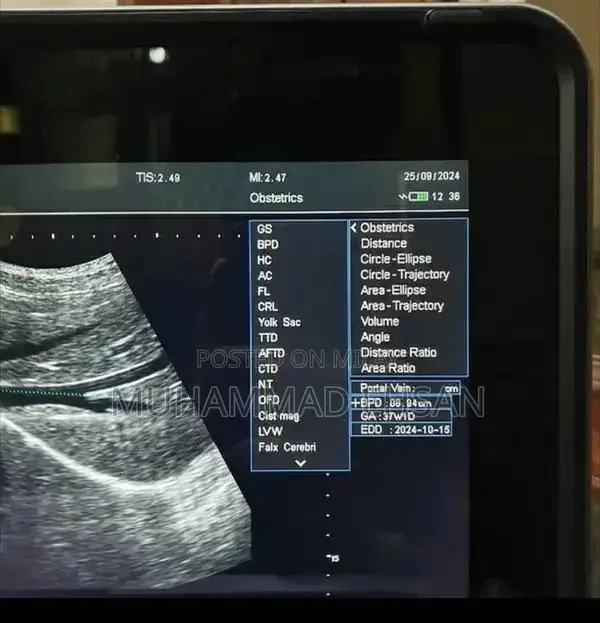 Portable Digital Grey Scale Ultrasound Diagnostic System