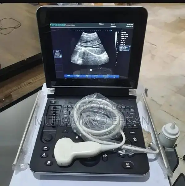 Portable Digital Grey Scale Ultrasound Diagnostic System