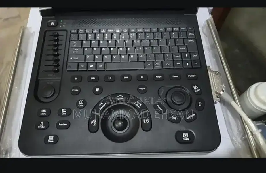 Portable Digital Grey Scale Ultrasound Diagnostic System