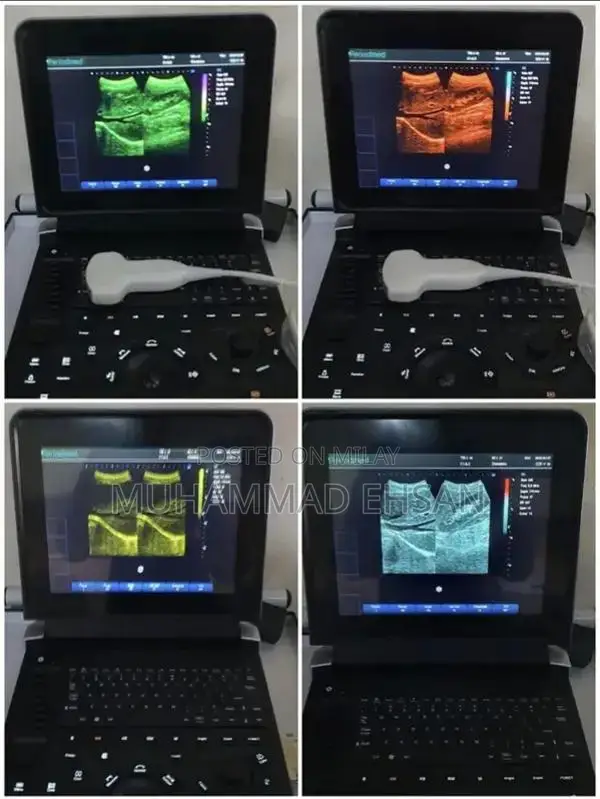 Portable Digital Grey Scale Ultrasound Diagnostic System