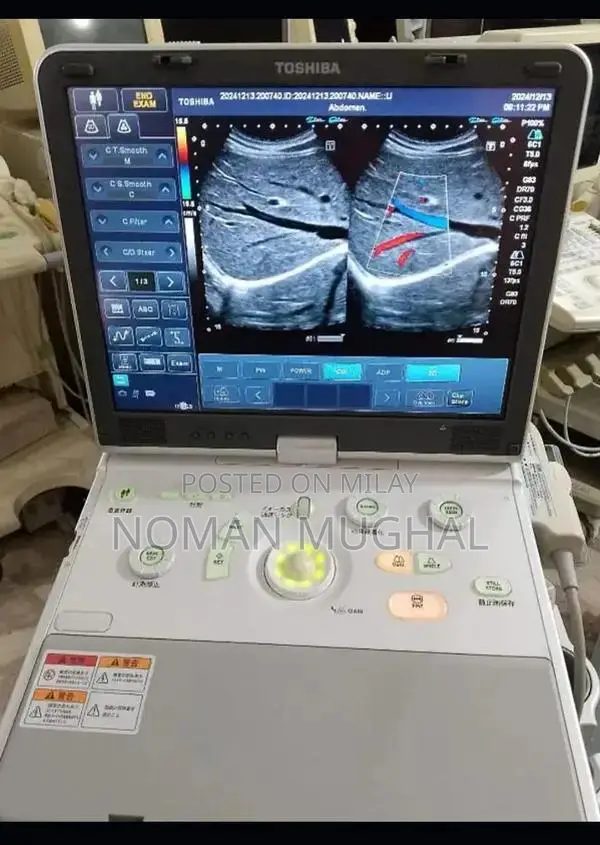 Professional Used and New Ultrasound Machines from Japan and USA