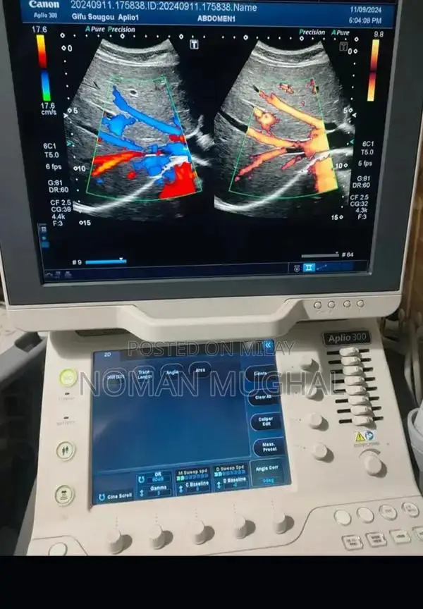 Professional Used and New Ultrasound Machines from Japan and USA