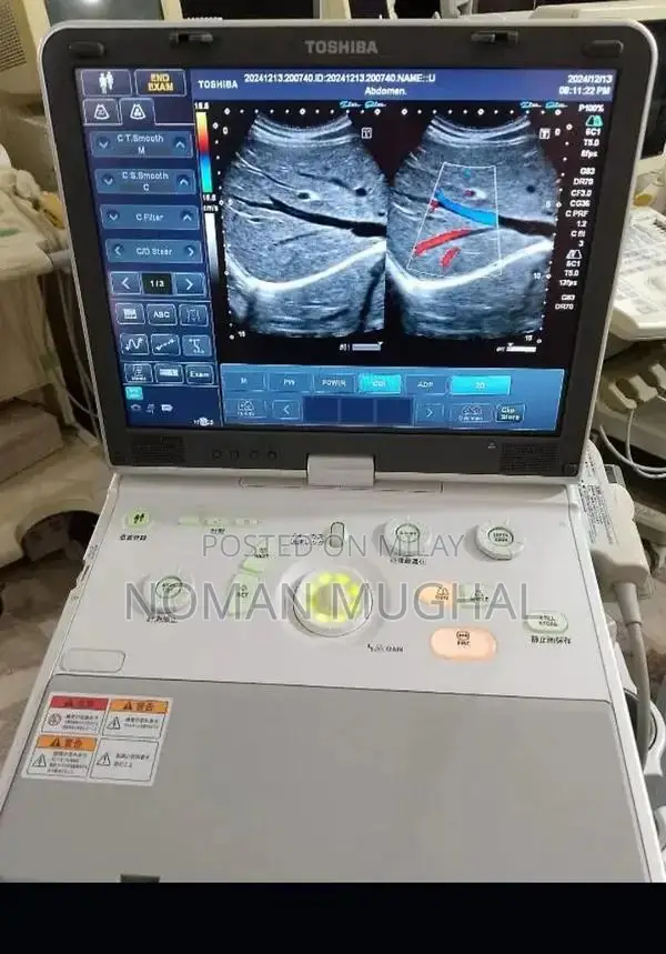 Professional Used and New Ultrasound Machines from Japan and USA