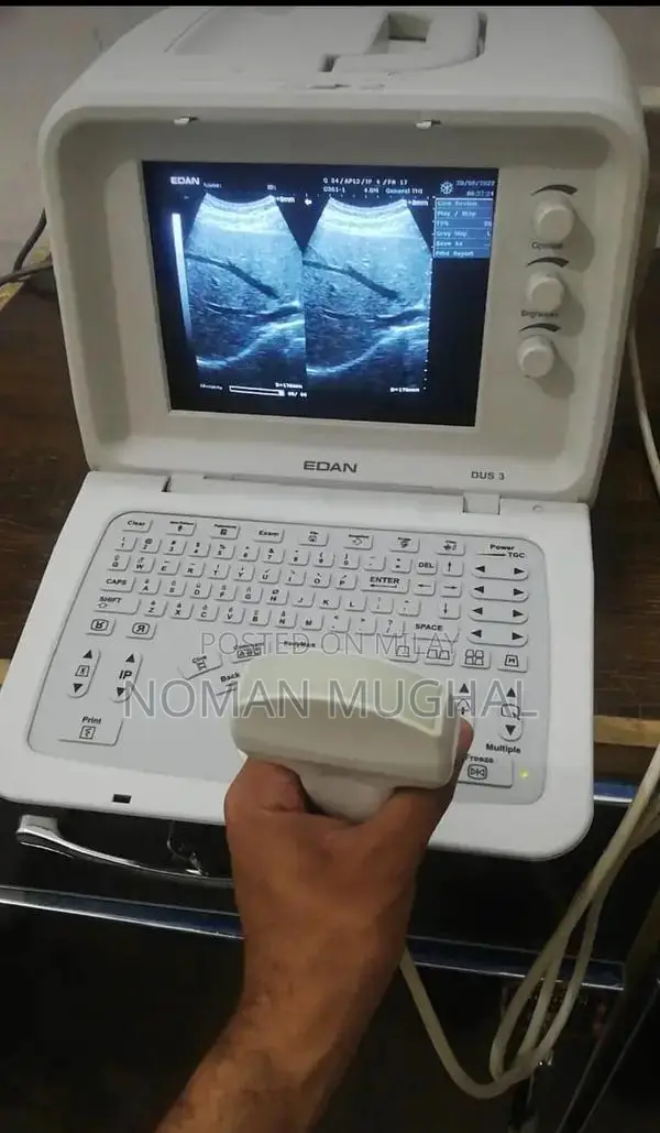 Professional Used and New Ultrasound Machines from Japan and USA