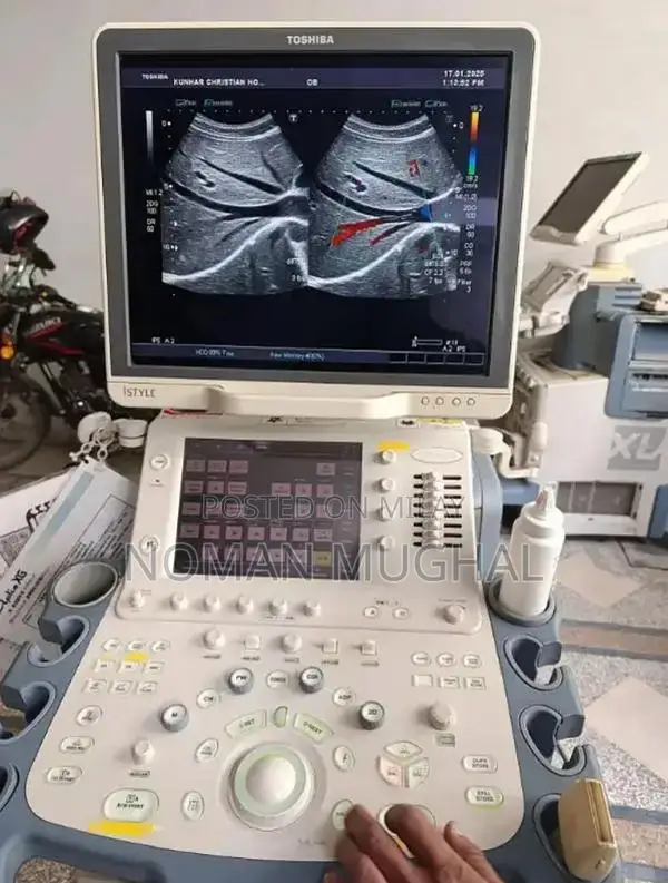 Professional Ultrasound Machines - Color Doppler & New/Used Options