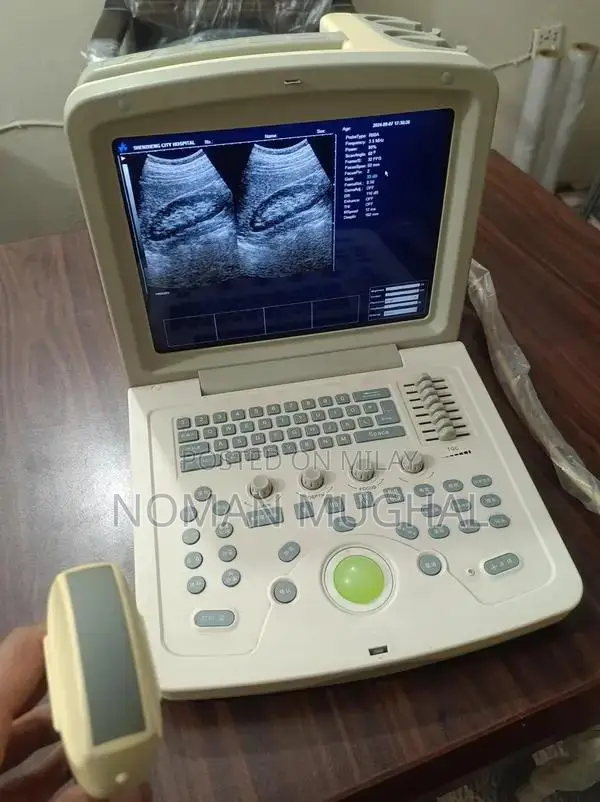 Professional Ultrasound Machines - Color Doppler & New/Used Options