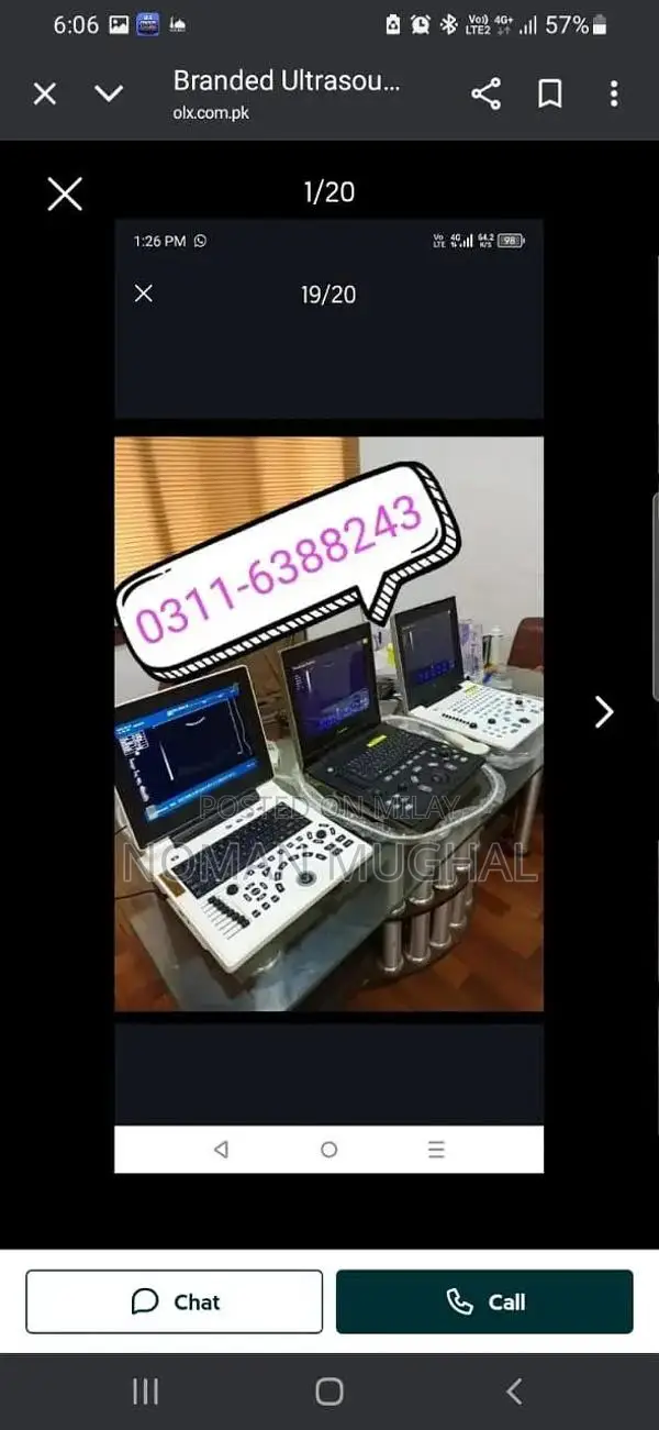 Professional Ultrasound Machines - Color Doppler & New/Used Options