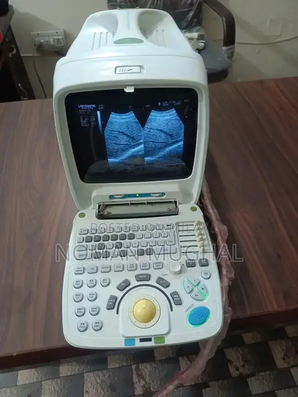 Professional Ultrasound Machines - Color Doppler & New/Used Options
