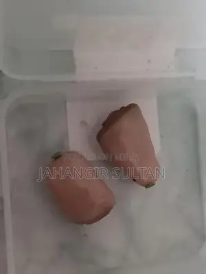 Photo - High-Quality Imported Digital Hearing Aids for Enhanced Sound Clarity