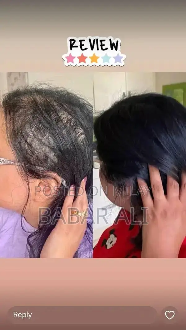 Organic Hair Growth Product for Nourishing and Repairing Hair