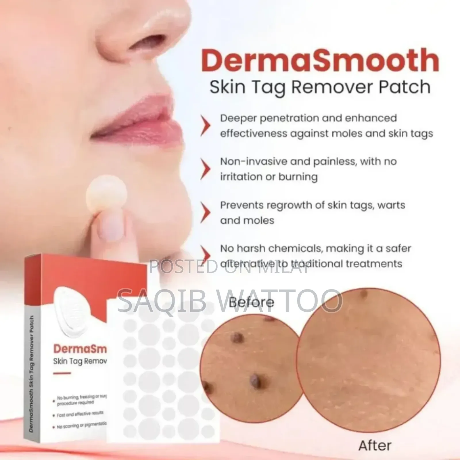 Dermasmooth Skin Tag Remover Patch | Fast, Safe Painles